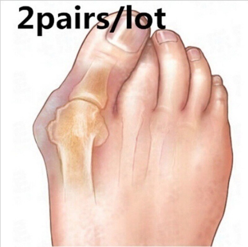 2Pcs Soft Silicone Toe Separator Straightener Thumb Crooked Thumb Toe Aligner Positioning Separator Foot Care Tool