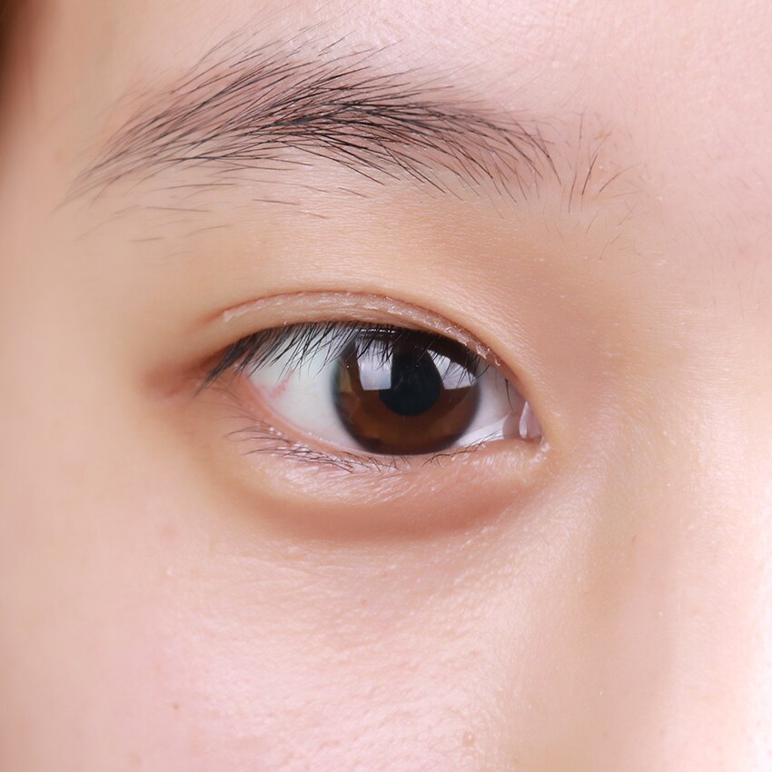 Augenlidband, Unsichtbare Doppelte Augenlidaufkleber