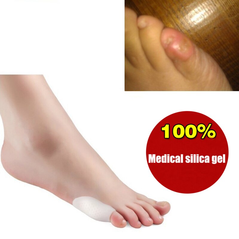 Füße Pflege Ballen Gel Wenig kissen Mantel Zehe Separator Orthesen Erleichtert Hallux Valgus Einlegesohlen Kompression Pad Kleine kappe silikon