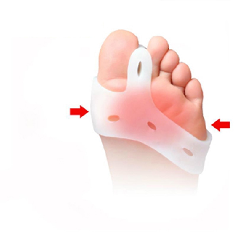1pair=2pcs Genuine Special Hallux Valgus Bicyclic Thumb Orthopedic Braces Toe Corrector Daily Silicone Toe Big Bone Bunion