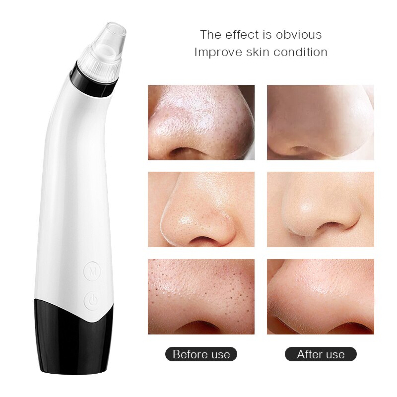 3 In1 Multifunctional LED Screen Vacuum Suction Beauty Device Anti Aging Face Lifting Tightening Eye Facial Skin Care 45G