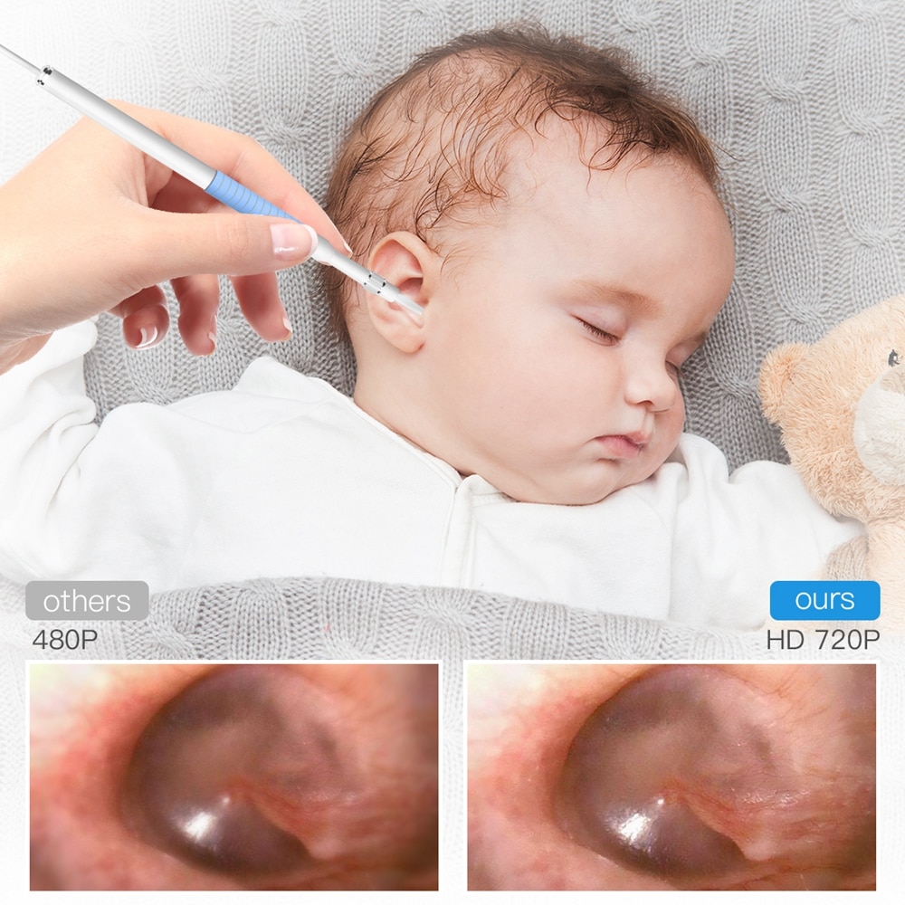 Endoscoop Camera Oor Schoonmaken Tool Ear Wax Remover Kit Care Oor Schoner Apparaat Oor Schoonmaken Persoonlijke Gezondheidszorg