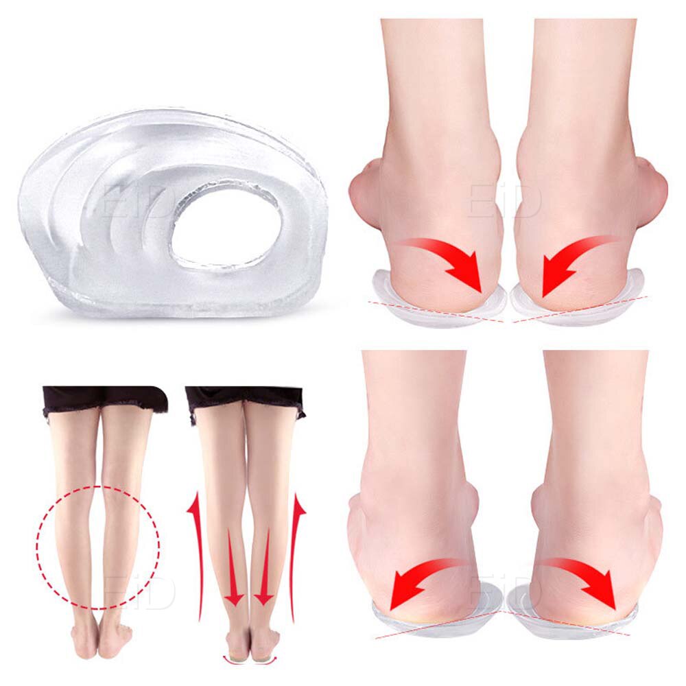Semelles orthopédiques en gel de silicone pour pieds plats, semelles de chaussures à soutien de voûte plantaire élevé, coussin orthopédique pour la correction, santé des jambes de bœuf, soins des pieds