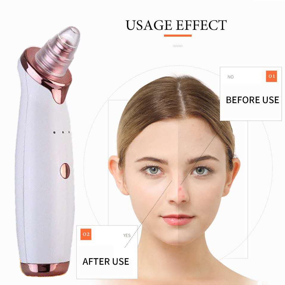 Vacuum Pore Cleaner Face Cleaning Blackhead Remover Tool Blackhead Pore Acne Removal Facial Cleansing Machine Skin Care Device#1