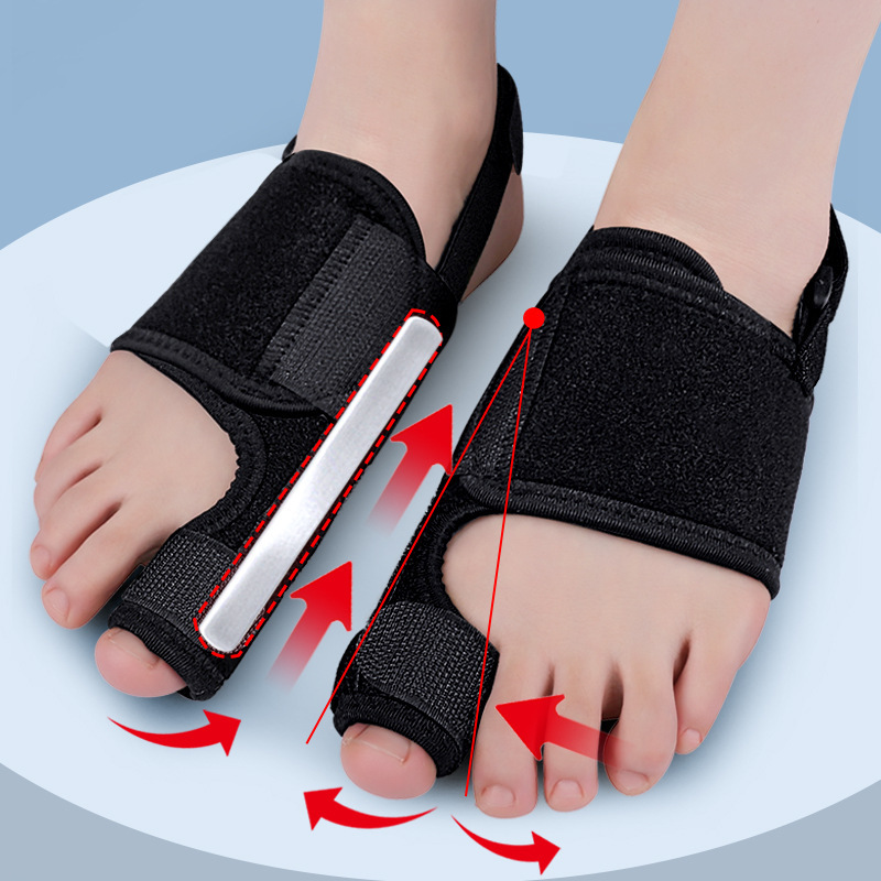 Ortopedisk hallux valgus-korreksjon, stortåseparator, smertelindring, ikke-kirurgisk hallux valgus-korreksjon, hammertårettingsverktøy