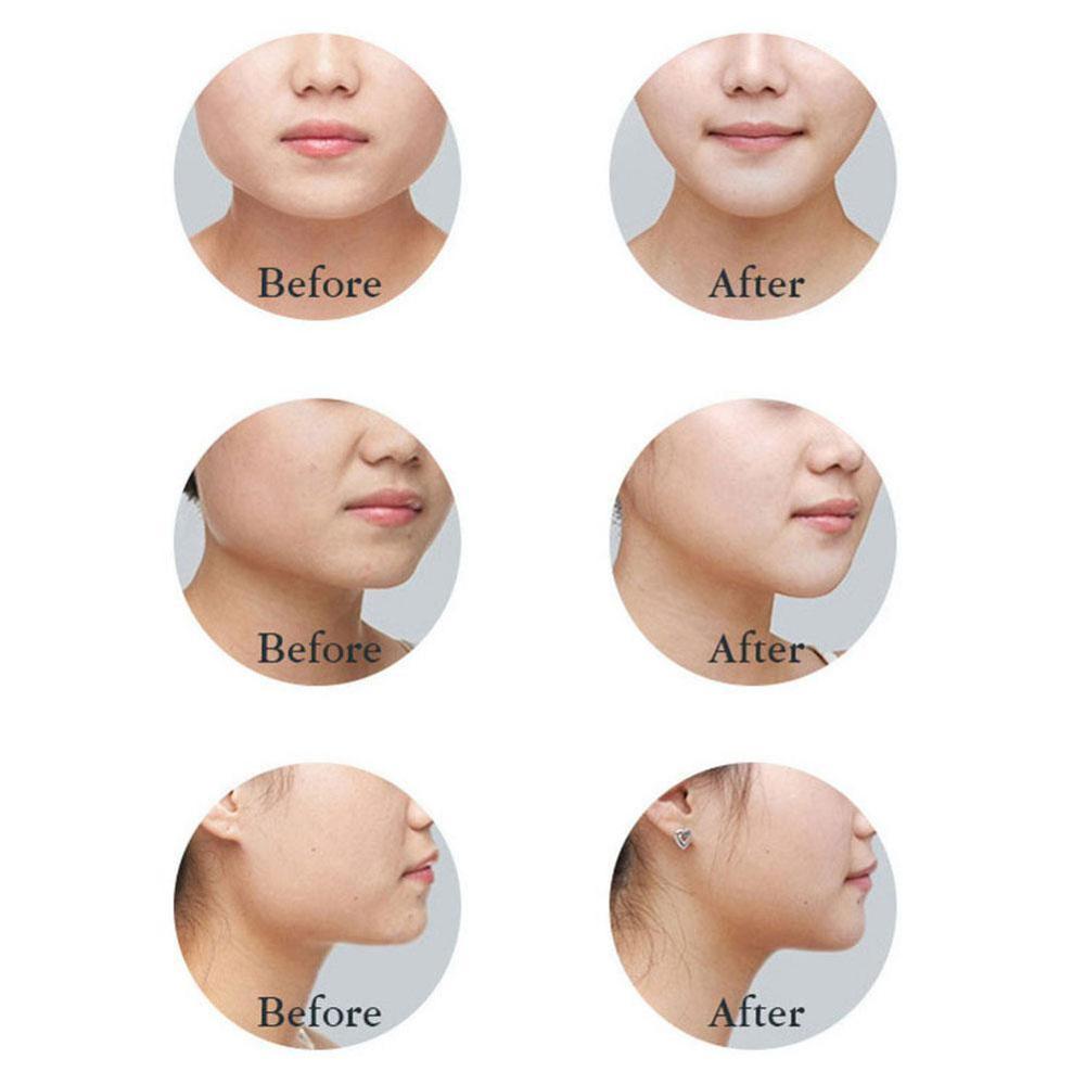 Corrective Face Mask Face Slim V-line Lift Up Cheek Correction To Chin Face Mask And Face Lifting Double-bar Firming Decree