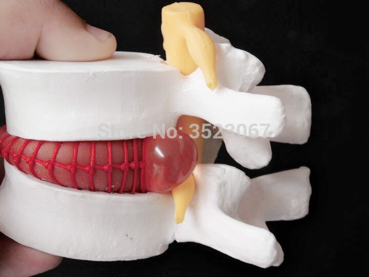 Szkielet anatomii człowieka kręgosłupa lędźwiowego przepuklina dysku Model nauczania 1:1. 5 czaszka mózg Model czaszki w urazie przyrządy medyczne