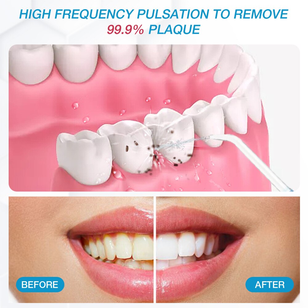 Waterpulse V300 Electric Oral Irrigator For Teeth Clean Dental Water Flosser 800ml Tank Oral Hygiene Cleaning 5 Jets Set