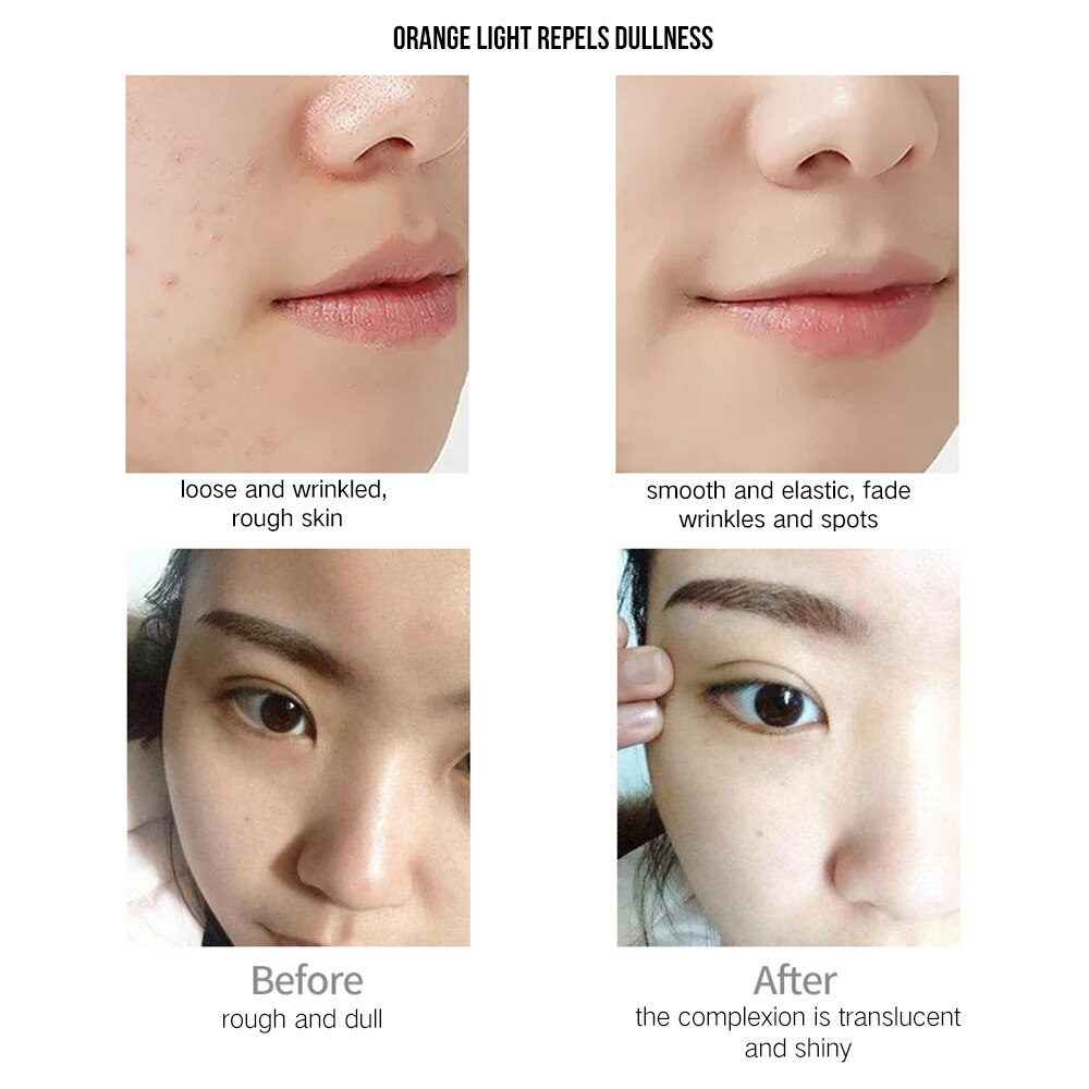 Photon Led Facial Mask Machin Lighting Tender Facial Skin Care Photon Therapy Anti Acne Spots Electric Beauti Salon Spa