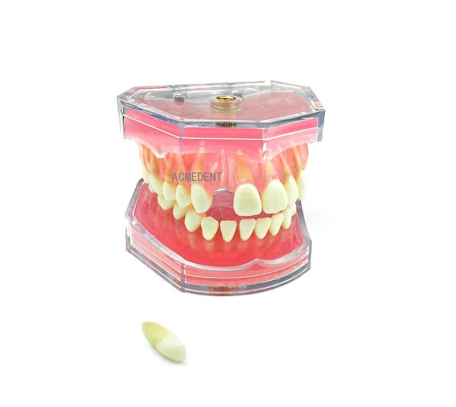 Dental Study Teaching Model Standard Model Removable Teeth Soft Gum Adult Typodont Model 3 Type