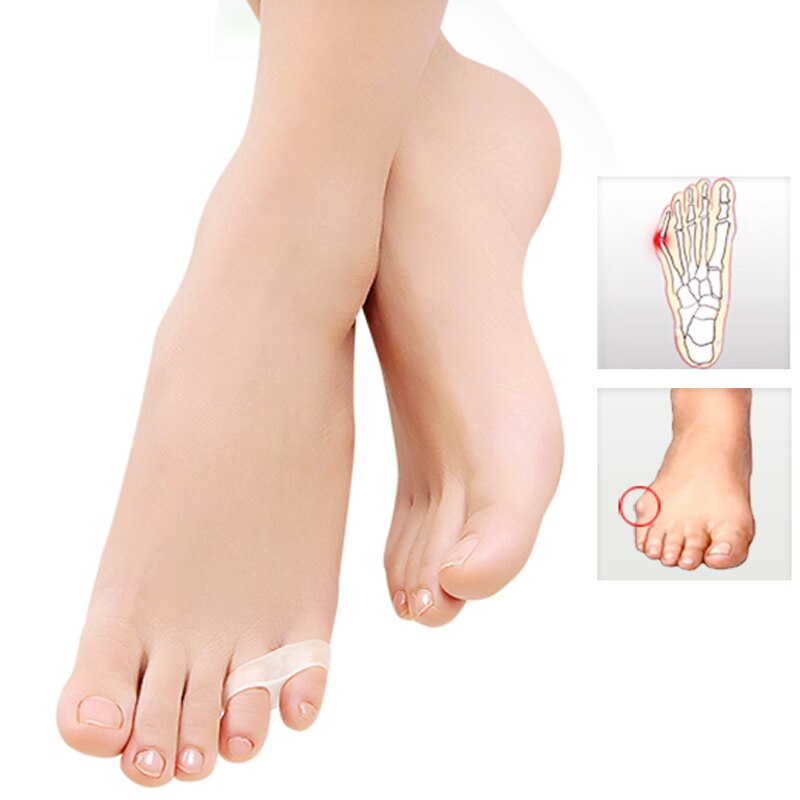 1-10 pair toe separador-interdigital-corrector-silicone-guarda pé-dedo-cuidado-ferramentas-alisador de união-pedicure-ortopédico