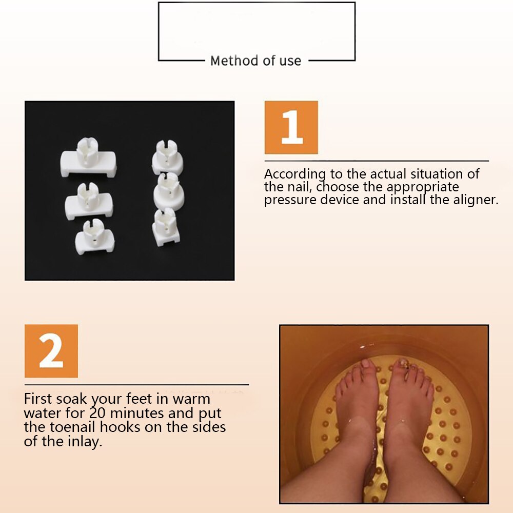 Ingrown toe pedicure foot care nail care tool foot correction nail thumb inflammation aligner for toe toe