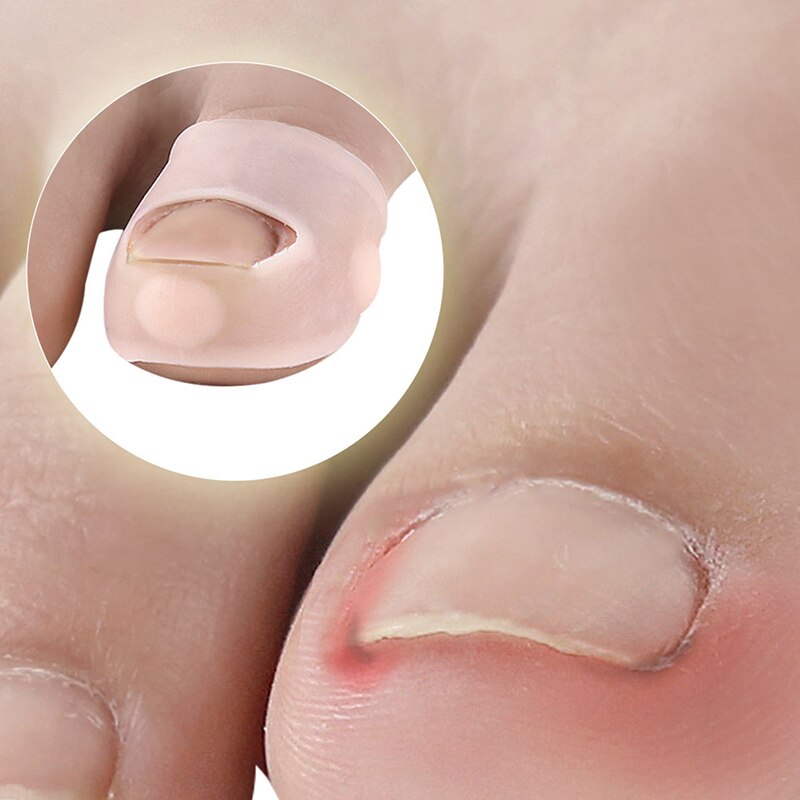 1 paar hallux valgus teenspreiders voetverzorgingstool silone stof hallux valgus correctie