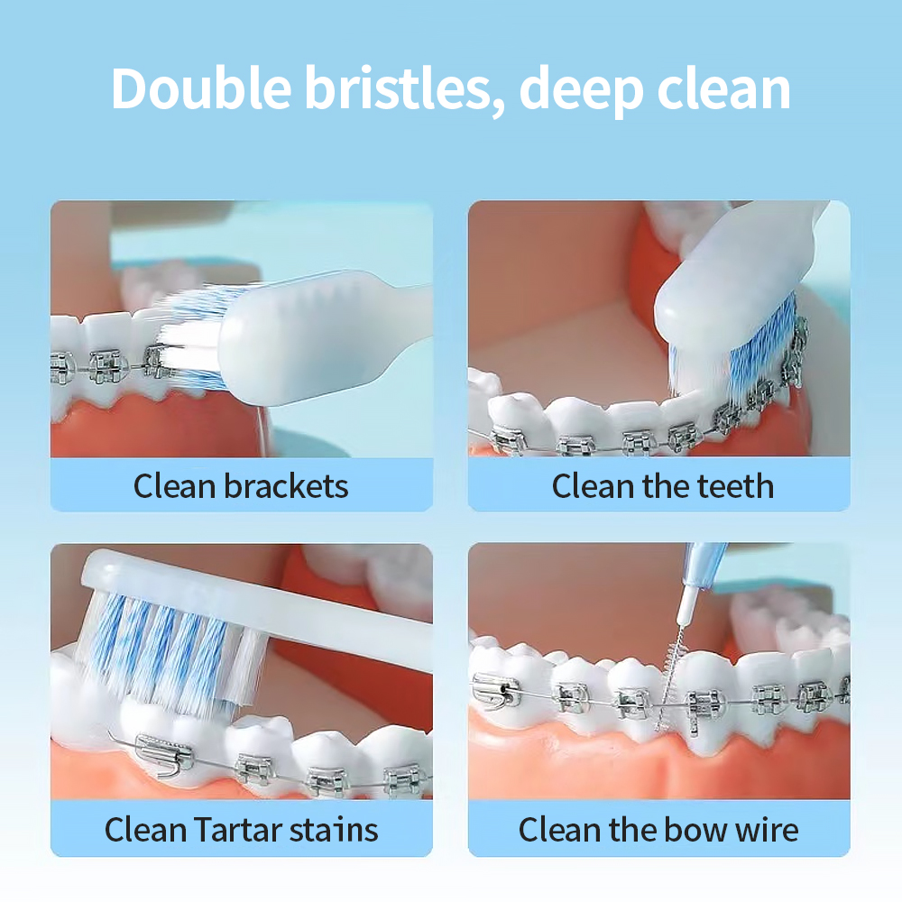 U-vormige Tandenborstel Orthodontie Diepe Reiniging Voor Beugels Volwassen Orthodontische Zachte Tandenborstels Orale Tandheelkundige Tandenborstel