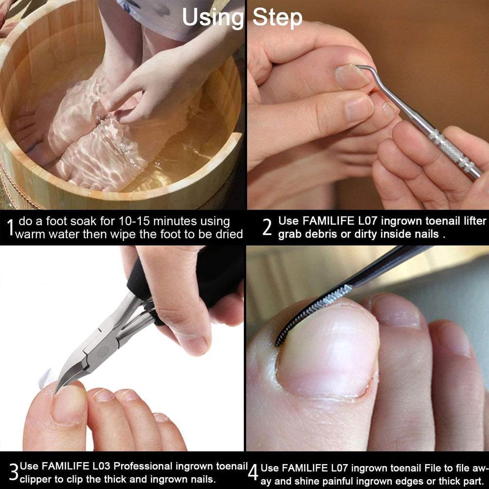 Lima de uñas para dedos de los pies, Lima de pedicura de doble punta, borde satinado, elevador de uñas encarnadas, onicomicosis, paroniquia, 1 ud.