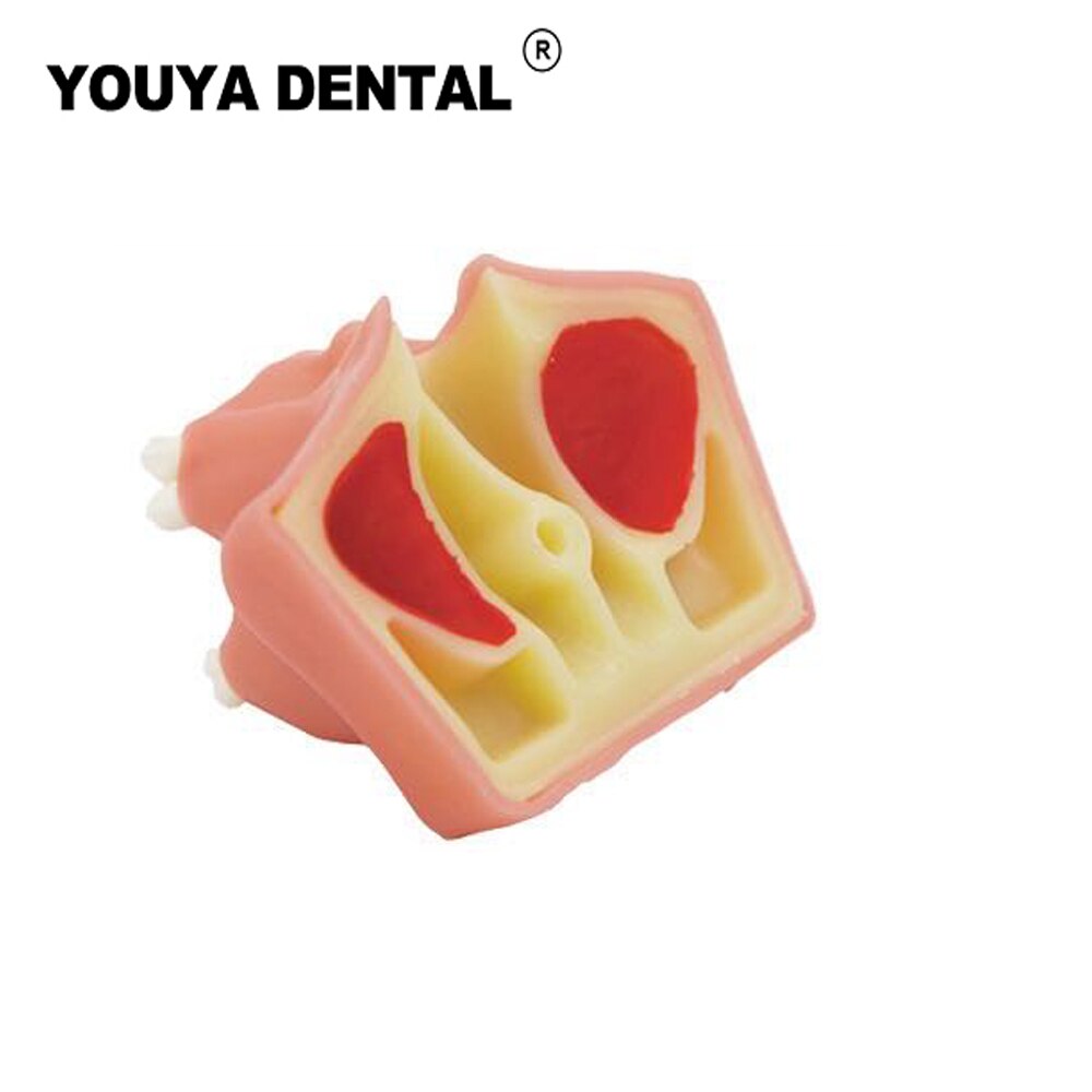 Teeth Implant Practice Model Maxillary Sinus Tooth Implant Model For Dentist Student Training Teaching Material