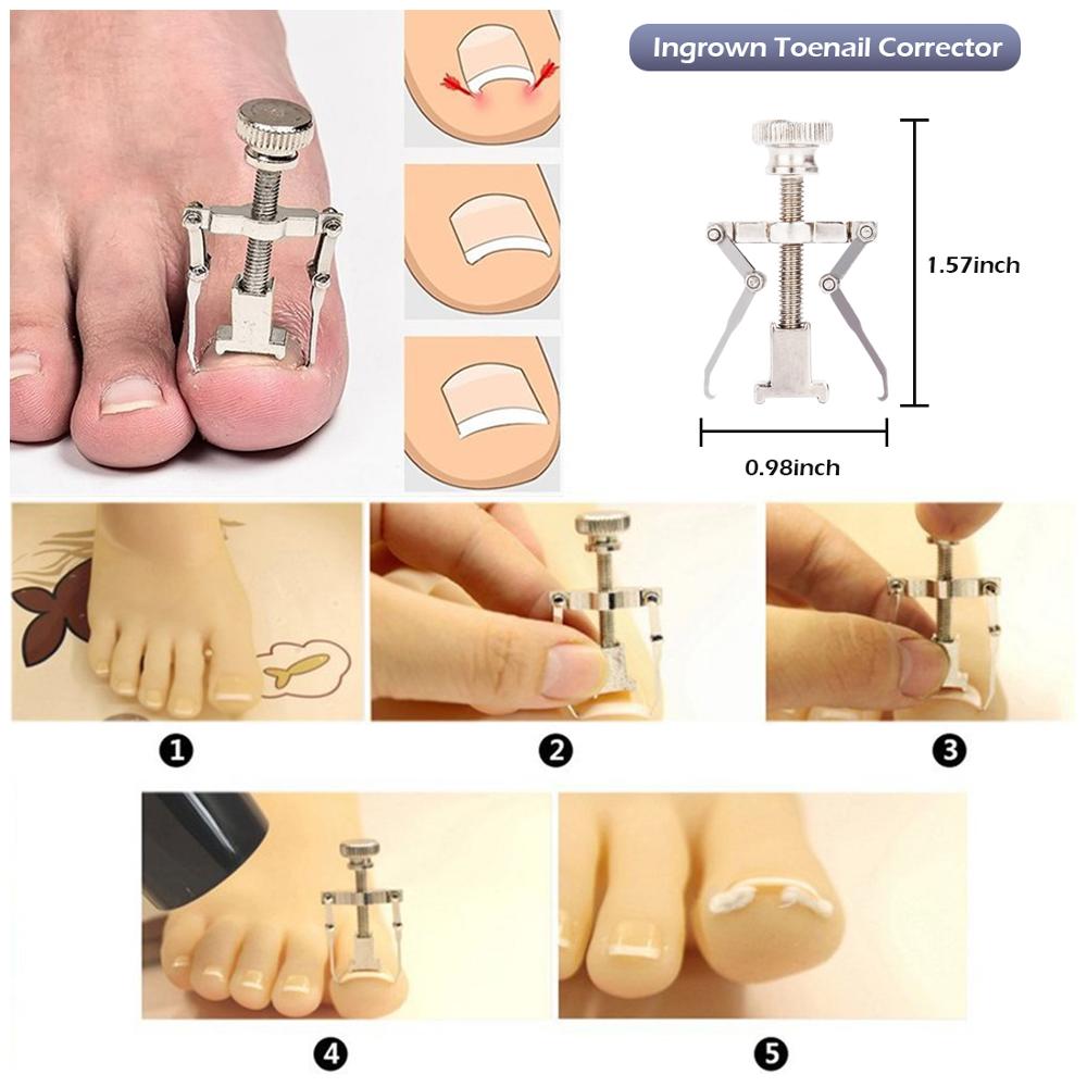 8 Stks/set Professionele Pedicure Gereedschap Ingegroeide Teennagel Gereedschap Kit Nail Care Ingegroeide Teennagel Verwijdering Correctie Clippers Voetverzorging