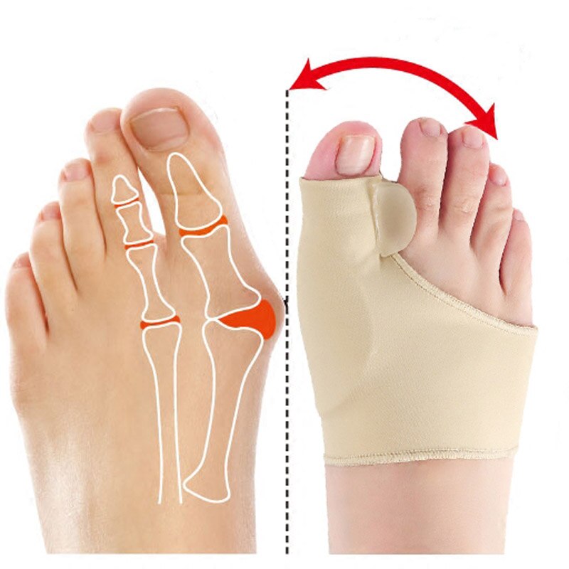 Calcetines ortopédicos de silicona para corrección de juanetes, Corrector de juanetes, Corrector de Hallux Valgus, separador de dedos de los pies, herramienta para el cuidado de los pies, 1 par