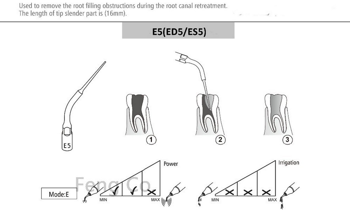 ES5 Ultraschall Scaler Tipps Für SIRONA SIROSON Handstück Endo Perio Zahn Skalierung Spitze Zahnarzt Zähne Bleichen