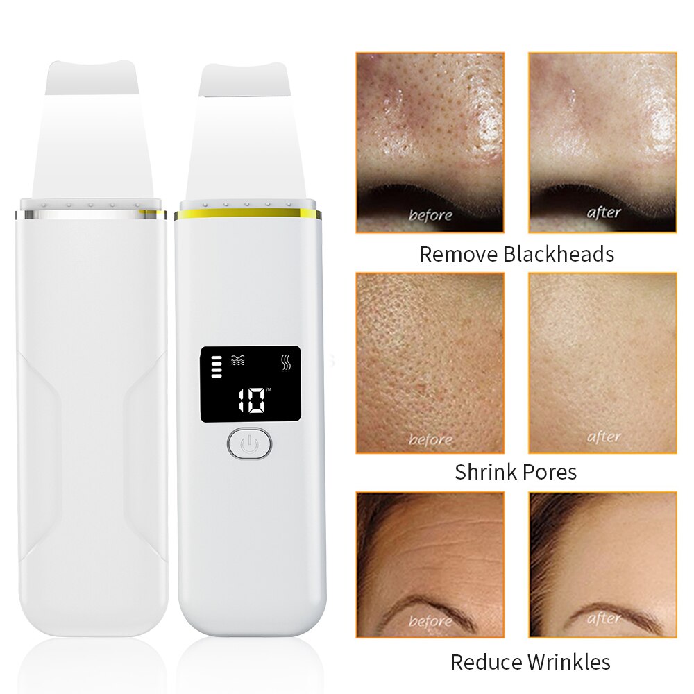 Facial Ultrasonic Skin Scrubber Blackhead Remover Skin Spatula Face Gentle Scraper Lifting Peel Pore Clean Comedones Extractor