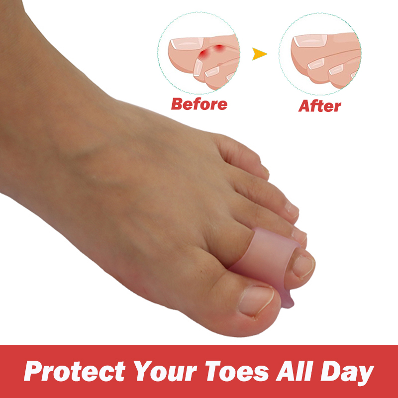 Pexmen 2Pcs Hammertoe Corrector Toe Splints Soft Gel Toe Straighteners Realign Bent Curled Crooked Claw and Hammer Toes