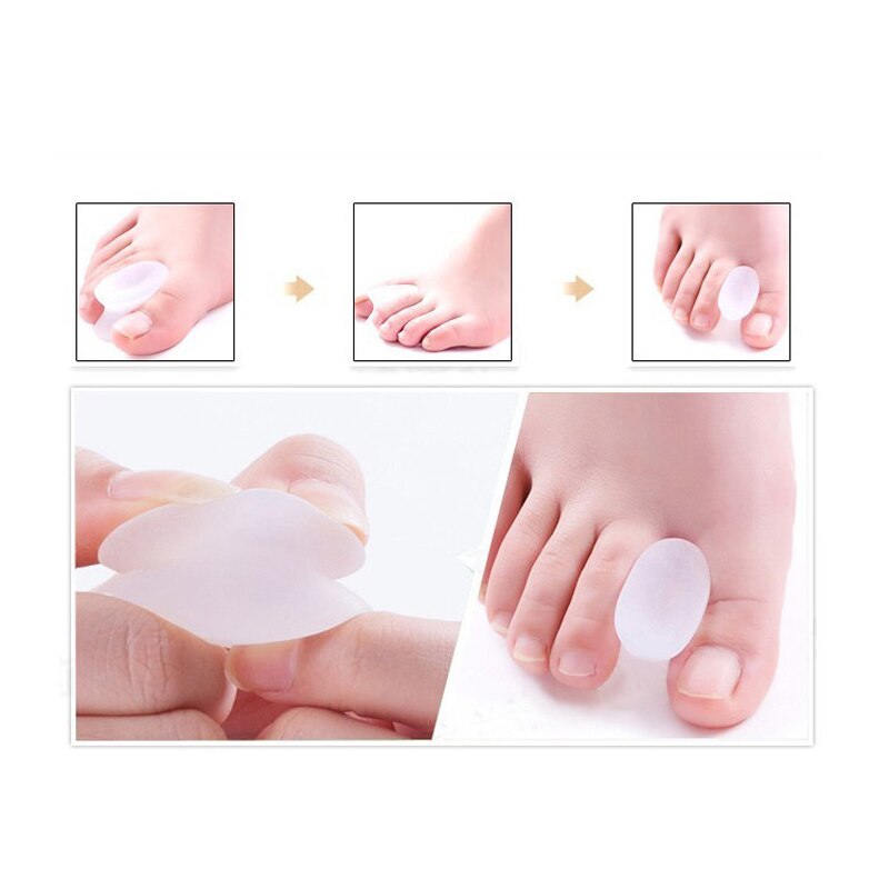 1Pair Big Toe Separator Silicone Gel Bunion Overlapping Protection Corrector Hallux Valgus Orthpedic Plantar Fasciitis Toes