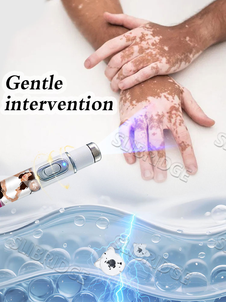 Vitiligo blåljuspenna, vitiligovårdsverktyg, unisex, generation -2, kombinationsset måltider
