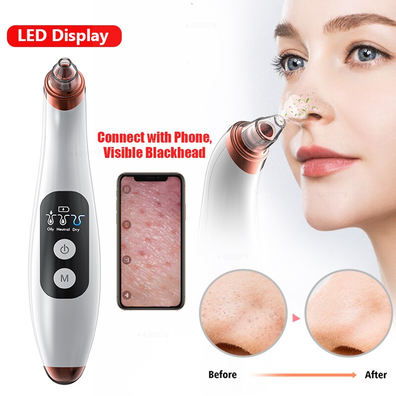 Blackhead Remover Face Deep Nose Cleaner T Zone Pore Acne Pimple Removal Vacuum Suction Facial Diamond Beauty Clean Skin Tool Bl