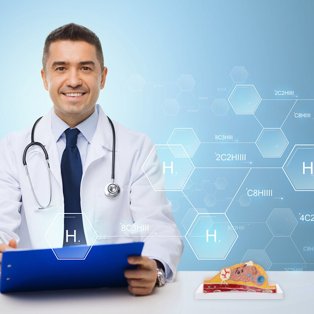 Female Breast Disease Pathology Model Udder Lesion Model Patient Communication