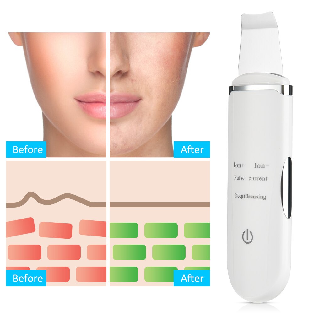 Ultrasonic Face Cleaner Skin Scrubber Deep Face Cleaning Machine Peeling Tool Skin Blackhead Removal Vibration Acne Exfoliating