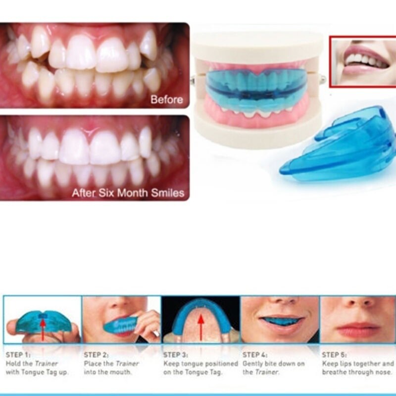 Sistema de Dientes rectos de ortodoncia para adolescentes y adultos, aparatos de silicona de 3 colores, de fábrica