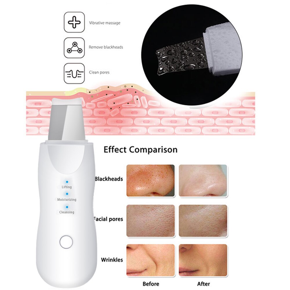 Appareil électrique de gommage de la peau, dissolvant de points noirs, spatule de Peeling du visage, Machine de Lifting du visage, amincissant, masseur à rouleau