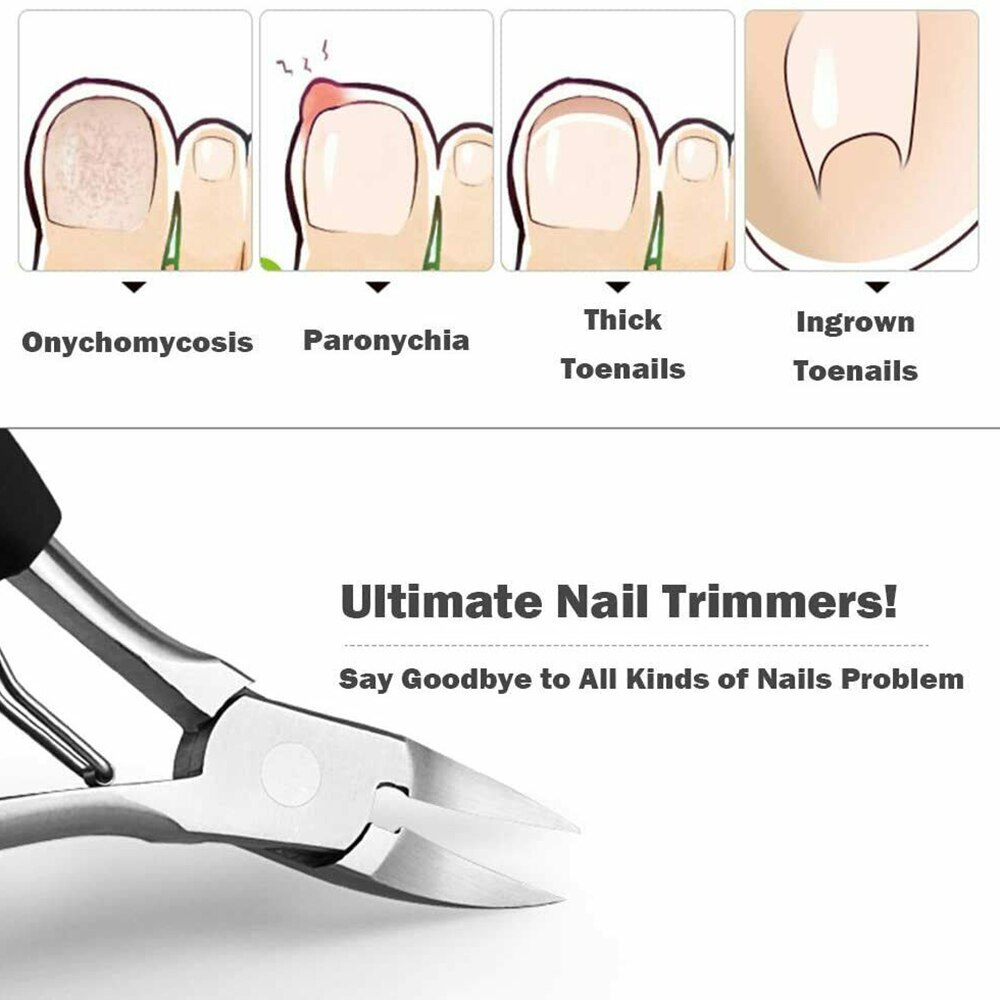 Grande pince Olecranon Paronychia spécial tondeuses enfants adulte acier inoxydable orteil coupe-ongles pédicure incarné ongles outils