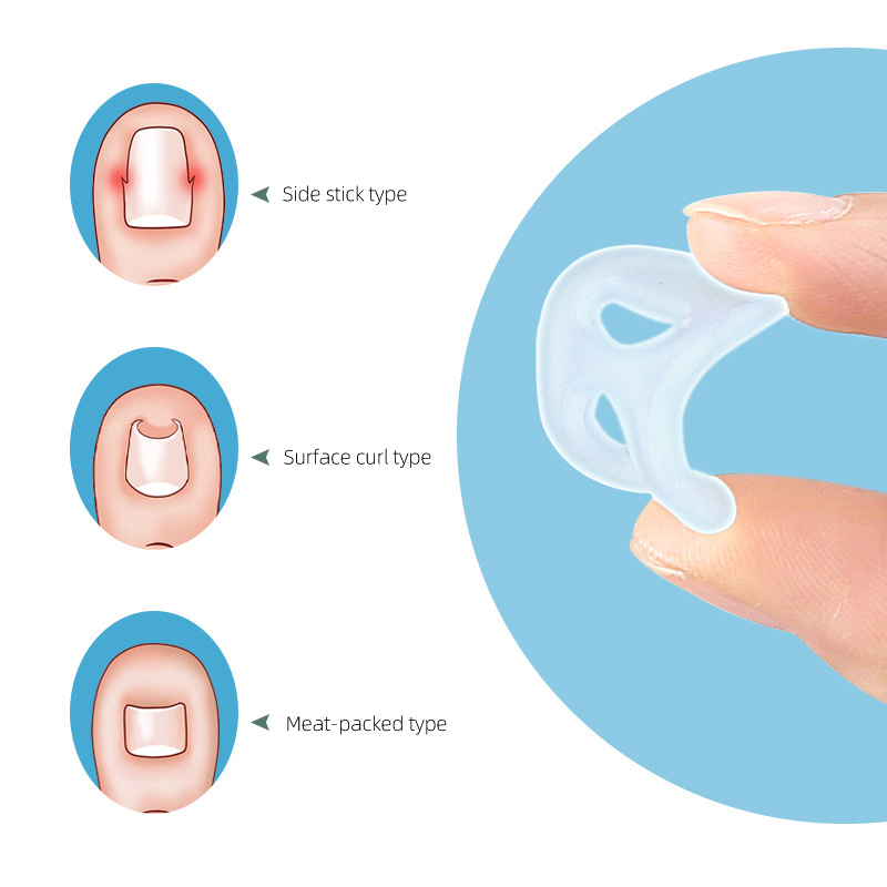 1 stk. silikone nedgroet tånegl korrektion usynlig nedgroet tå fingernegl glatning beskytter bøjle pedicure fodplejeværktøj