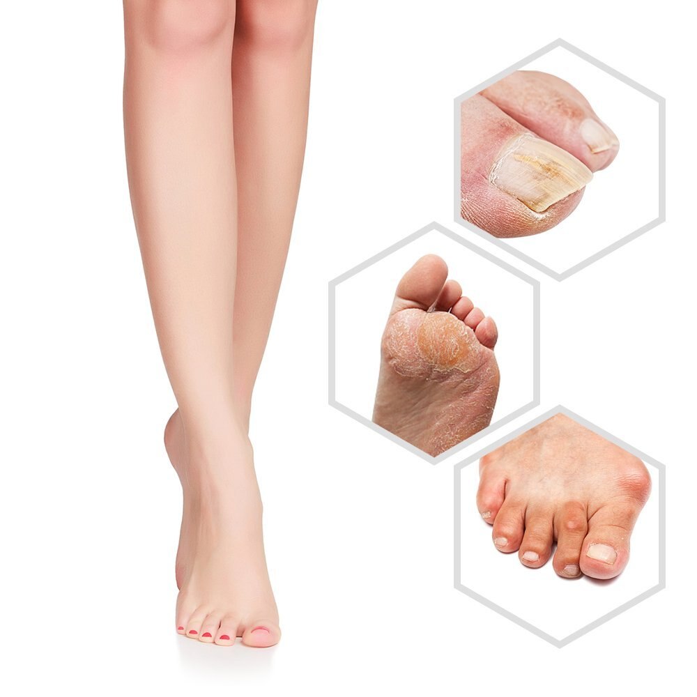 USB Rechargeable Electric Foot File Footbath Exfoliating Calluses Pedicure Electric Foot Pedicure Exfoliating Foot File Tool