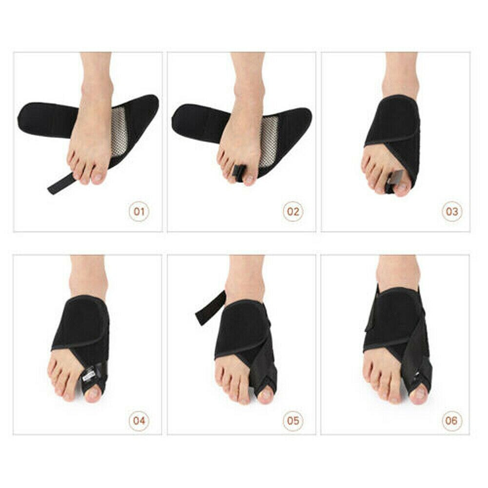 1 paar Grote Teen Bunion Corrector Teen Separator Correctie Hallux Valgus Voetverzorging Voeten Klittenband Peds Liners