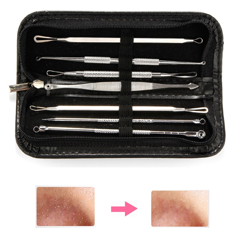Kit d&#39;extraction comédon de points noirs et avec pince pour boutons, soin de la peau, 7 pièces