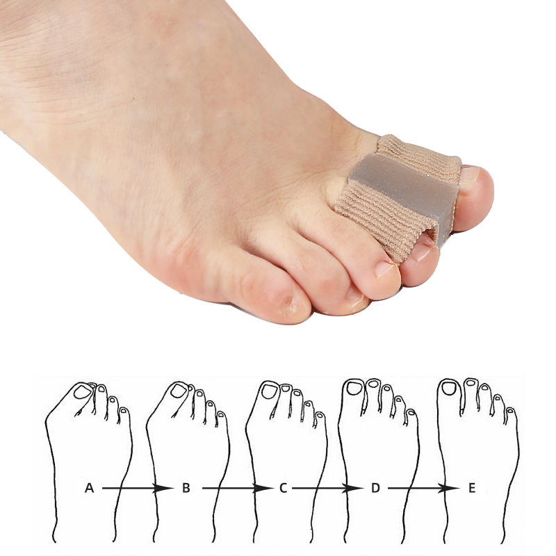 1PCS Toe Separator Hallux Valgus Bunion Corrector Orthesen Füße Knochen Daumen Teller Korrektur Pediküre Füße Haarglätter