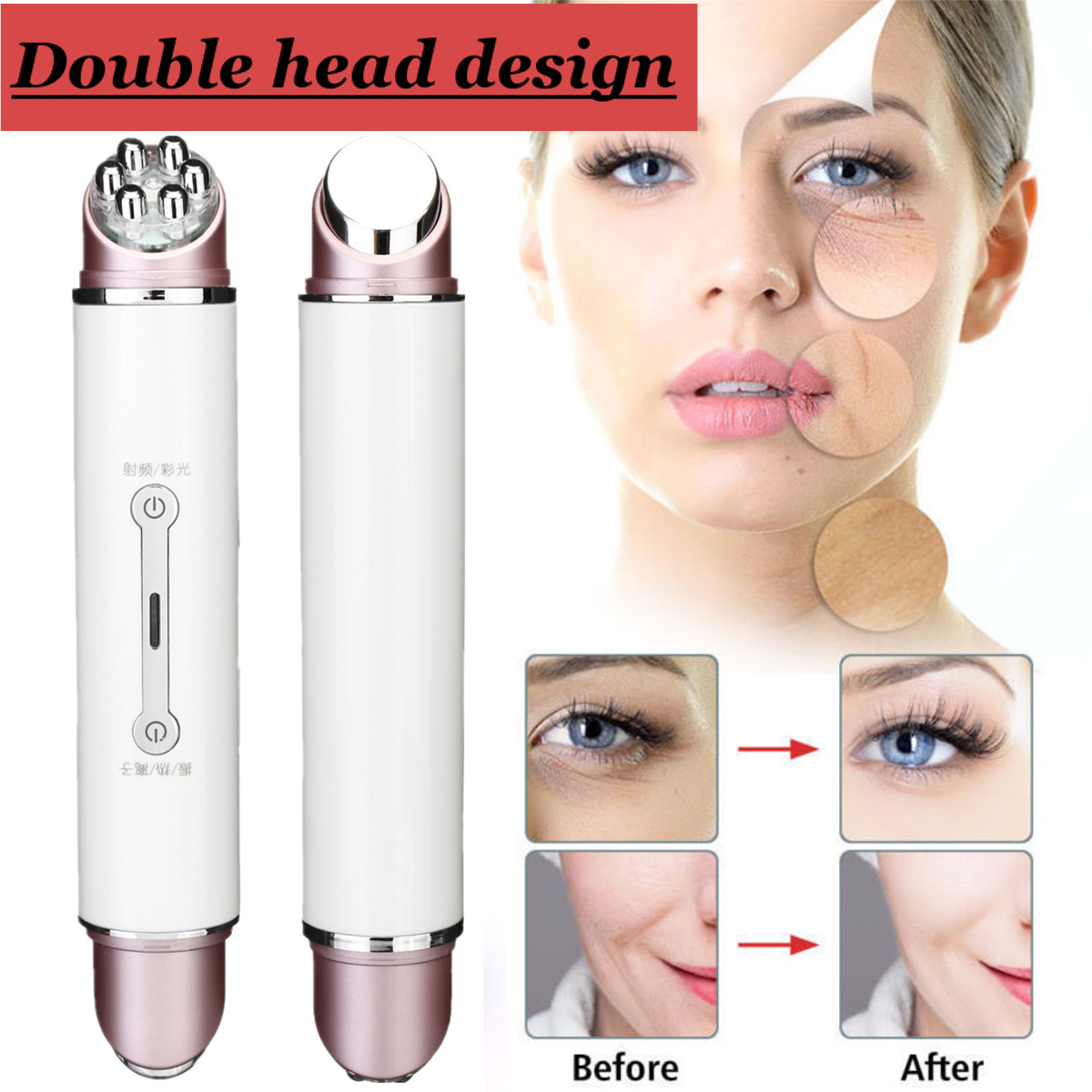 Double Head RF & EMS Radio Frequency Mesotherapy Electroporation Face Wrinkle Remove Pen Frequency Photon Face Skin Rejuvenation