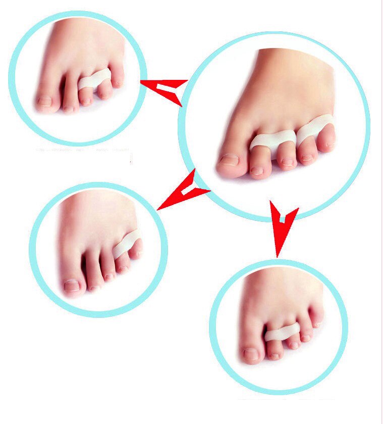 4 st = 2 par silikon lilltå pinky pinkie tåskydd orthotics separator svanstå plattång daglig användning 4 st innersula