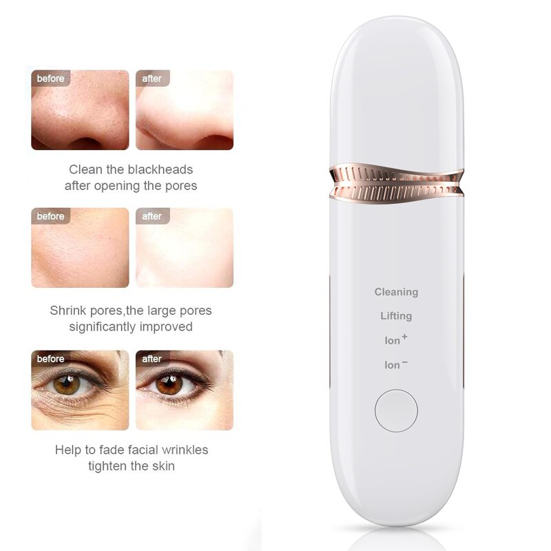 Ultrasonic Skin Scrubber Face Spatula Blackhead Remover Deep Facial Cleansing Skin Scraper Ultrasonic Cavitation Peeling