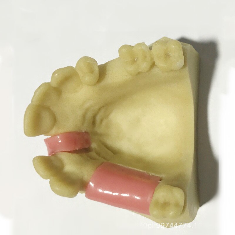 Práctica de sutura gingival suave de 7 tipos, formación Dental, implante de simulación de práctica de implante, modelo de dientes faltantes osteoaxilares: Gris