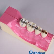 Dental Disease Teeth Anatomy Study Model Molar Cross Section Model