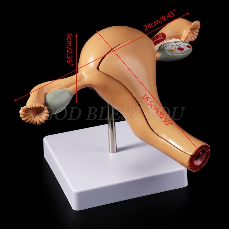 Human Pathological Uterus Ovary Model Anatomical Anatomy Disease Pathology Lesion For Teaching