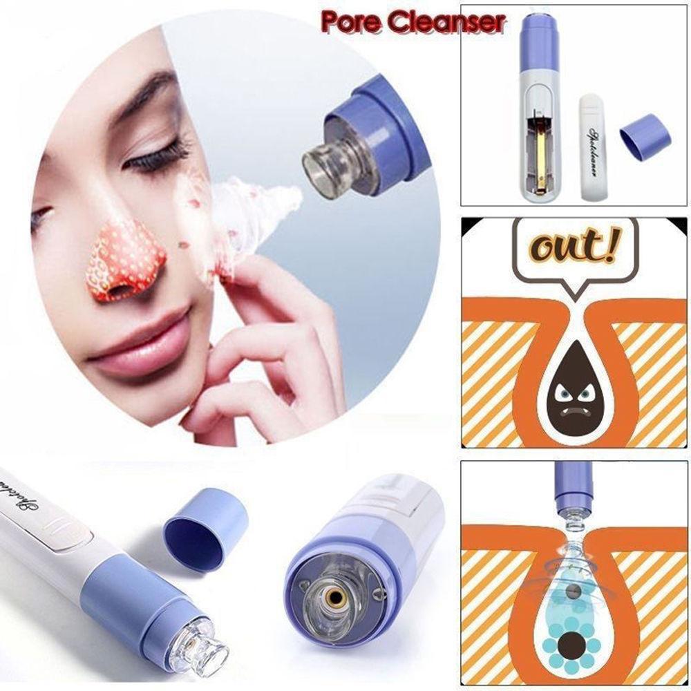 Electric Facial Pore Blackhead Cleaner Remover Vacuum Acne Microdermabrasion Facial Pore Cleanser Blackhead Suction Remover