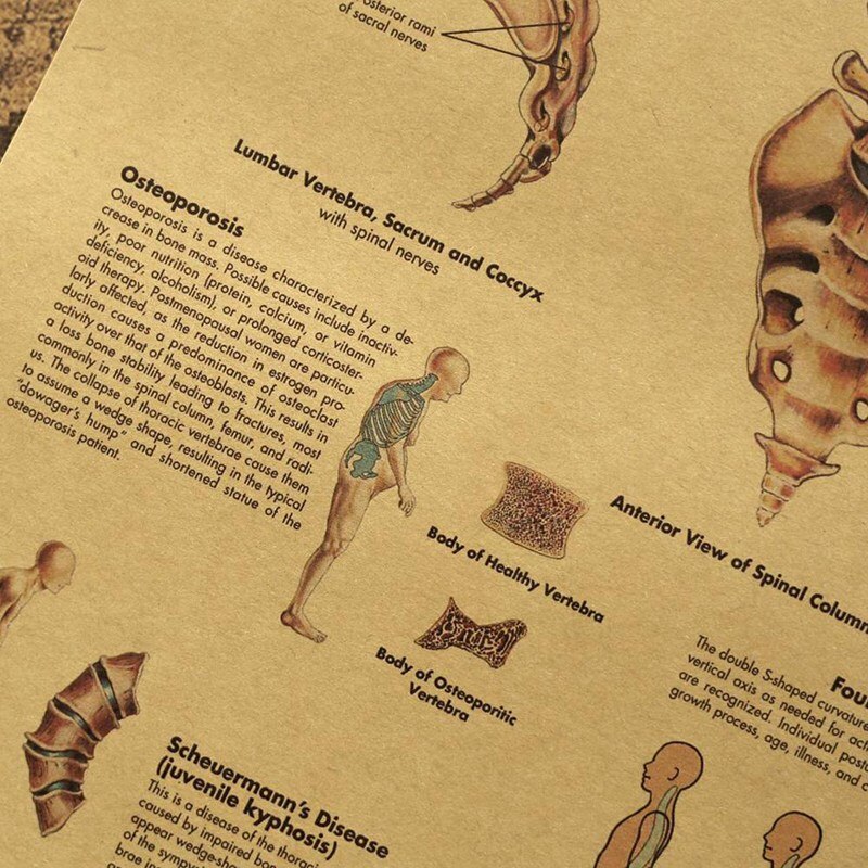 Retro Human Body Structure Diagram Back Spine Nerve Structure Diagram Poster Home Decor Kraft Paper Wall Sticker 42x30cm