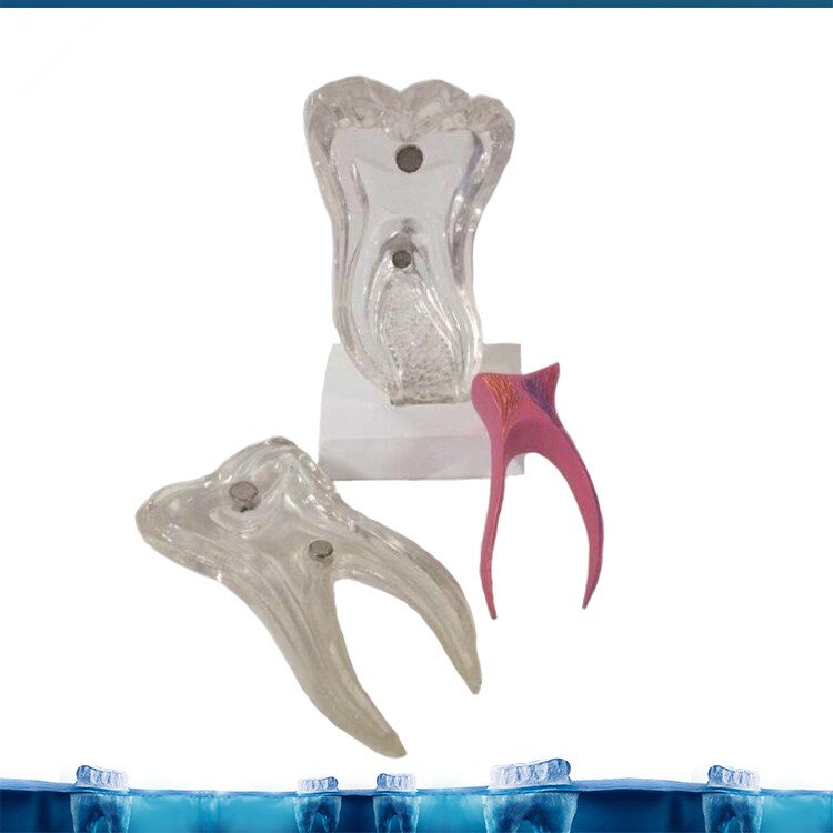 6X Zes Keer De Tand Zenuw Anatomie Onderwijs Model Pathologische Tandheelkundige Tand Tanden Anatomie Model Medische Anatomie Odontologia