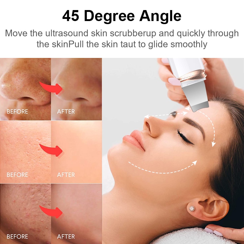 Ultrasone Huid Scrubber Comedondrukker Ion Diepe Gezicht Reiniging Schop Gezicht Spatel Cavitatie Peeling Ems Huid Reinigen
