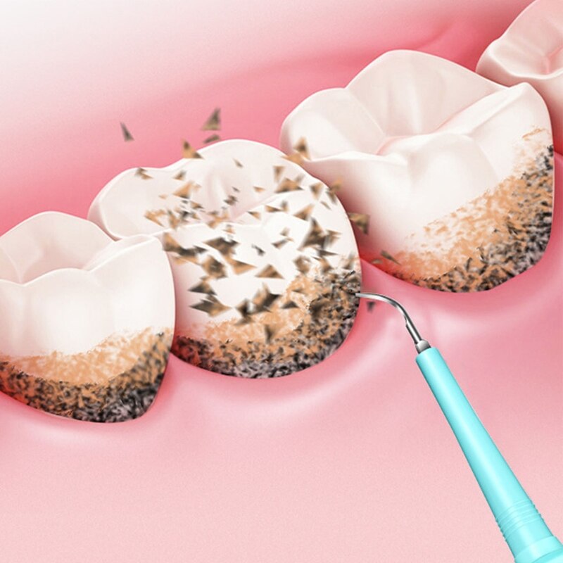 Dental Calculus Remover with 3 Replaceable Clean Heads Tartar Scraper for Teeth 3 Cleaning nodes Electric