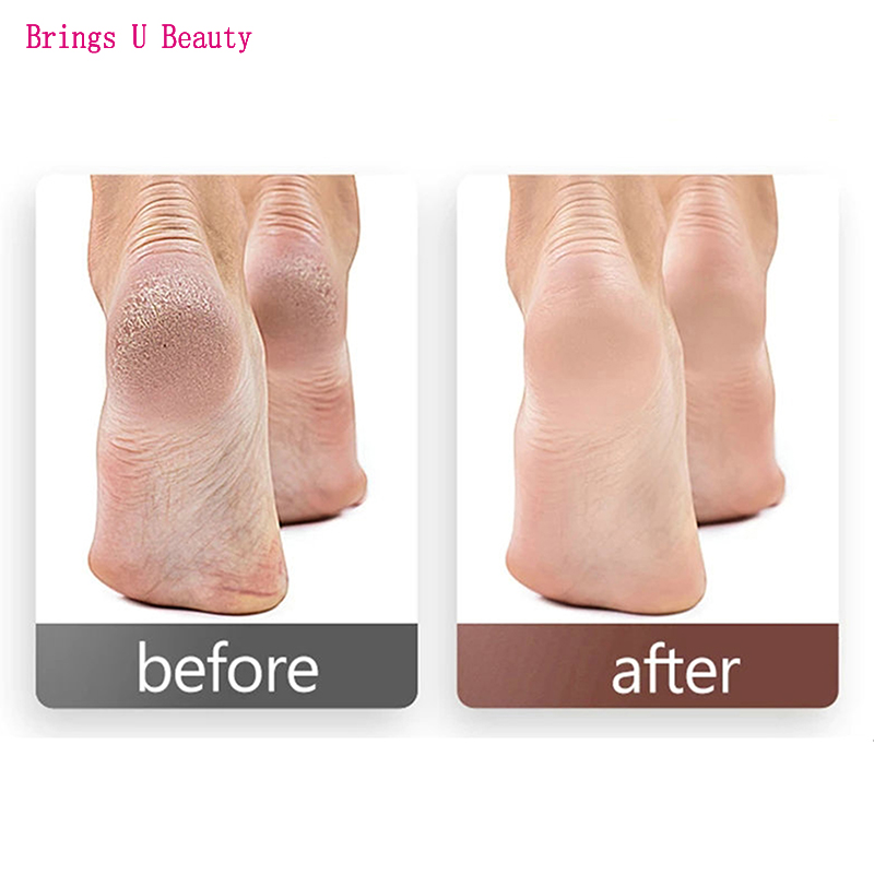 100pcs Disc Cuticle Callus Remove Tool For Electric Foot File Callus Hard Dead Skin Pedicure Tools Replaceable Sandpaper